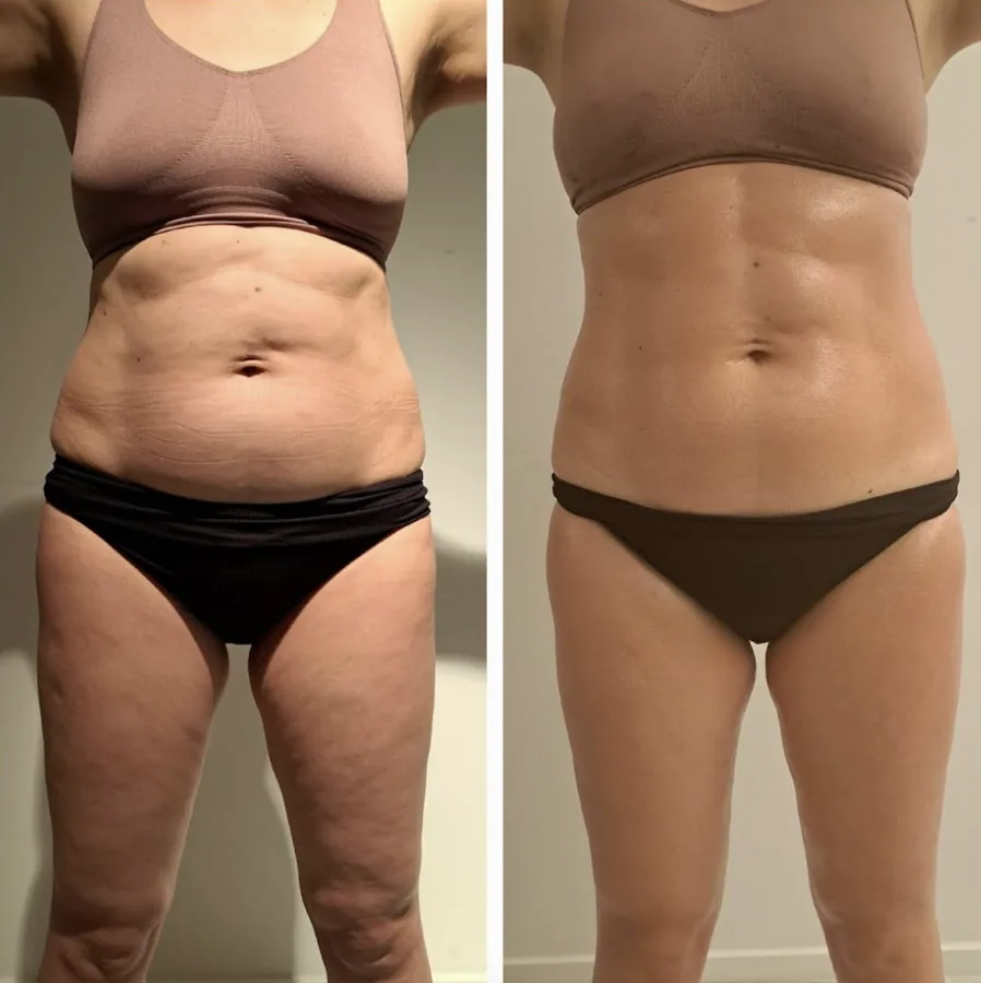 Resultaat van de Active Wrap