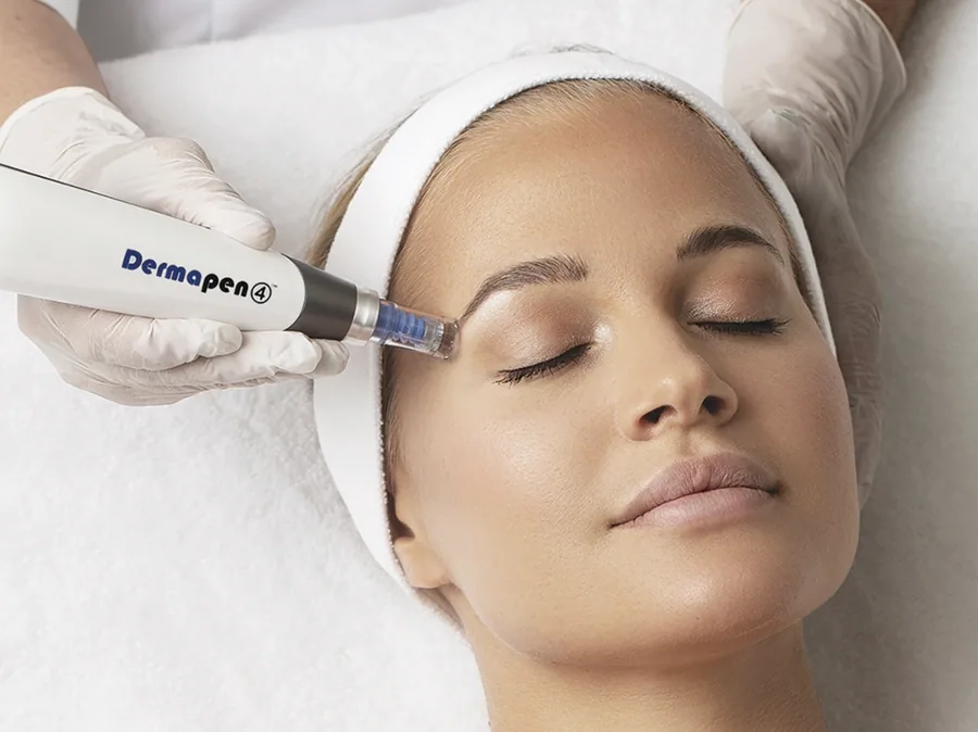 Microneedling in de behandelkamer